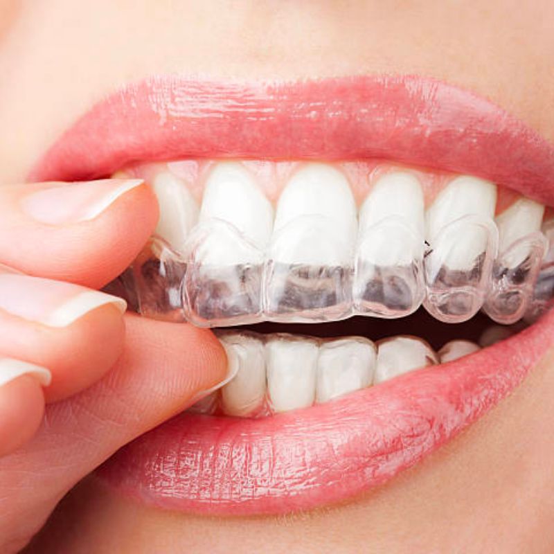 mail aligners