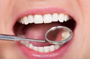 dentist checking for cavities